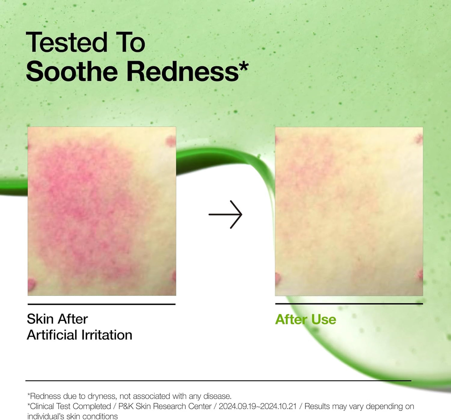 Anua Azelaic Acid 10 Hyaluron Redness Soothing Serum